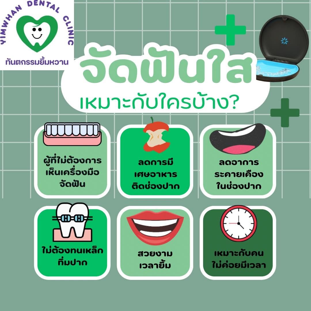 จัดฟันใส (Clear Aligner)