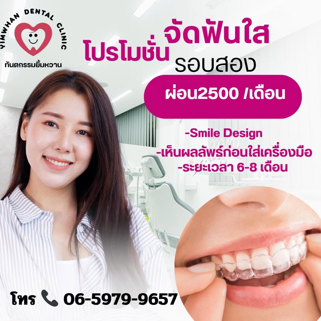 จัดฟันใส (Clear Aligner) คืออะไร? เหมาะกับใครบ้าง?